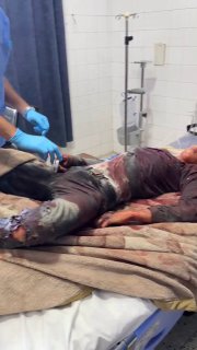 👤 محمود صابر بصل 📝 A child was martyred and another child was injured from the Totah family, as a result of a "quadcopte